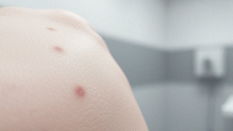 Jakie procesy naprawcze zachodzą w skórze po zabiegu?